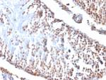 Wilm's Tumor 1 (WT1) (Wilm's Tumor and Mesothelial Marker) Antibody in Immunohistochemistry (Paraffin) (IHC (P))