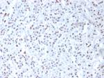 Wilm's Tumor 1 (WT1) (Wilm's Tumor and Mesothelial Marker) Antibody in Immunohistochemistry (Paraffin) (IHC (P))