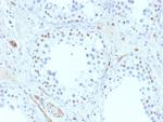 Wilm's Tumor 1 (WT1) (Wilm's Tumor and Mesothelial Marker) Antibody in Immunohistochemistry (Paraffin) (IHC (P))