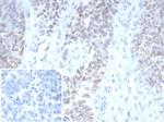 Wilm's Tumor 1 (WT1) (Wilm's Tumor and Mesothelial Marker) Antibody in Immunohistochemistry (Paraffin) (IHC (P))