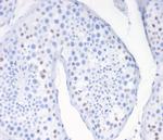 Wilm's Tumor 1 (WT1) (Wilm's Tumor and Mesothelial Marker) Antibody in Immunohistochemistry (Paraffin) (IHC (P))