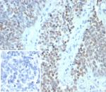 Wilm's Tumor 1 (WT1) (Wilm's Tumor and Mesothelial Marker) Antibody in Immunohistochemistry (Paraffin) (IHC (P))