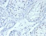 Wilm's Tumor 1 (WT1) (Wilm's Tumor and Mesothelial Marker) Antibody in Immunohistochemistry (Paraffin) (IHC (P))