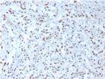 Wilm's Tumor 1 (WT1) (Wilm's Tumor and Mesothelial Marker) Antibody in Immunohistochemistry (Paraffin) (IHC (P))