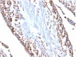 Wilm's Tumor 1 (WT1) (Wilm's Tumor and Mesothelial Marker) Antibody in Immunohistochemistry (Paraffin) (IHC (P))