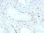 Wilm's Tumor 1 (WT1) (Wilm's Tumor and Mesothelial Marker) Antibody in Immunohistochemistry (Paraffin) (IHC (P))