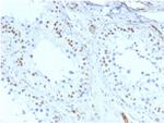 Wilms Tumor 1 (WT1) Antibody in Immunohistochemistry (Paraffin) (IHC (P))