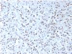 Wilms Tumor 1 (WT1) Antibody in Immunohistochemistry (Paraffin) (IHC (P))