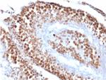 Wilms Tumor 1 (WT1) Antibody in Immunohistochemistry (Paraffin) (IHC (P))