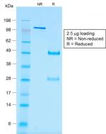 Wilms Tumor 1 (WT1) Antibody in SDS-PAGE (SDS-PAGE)