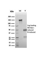 Wilms Tumor 1 (WT1) Antibody in SDS-PAGE (SDS-PAGE)