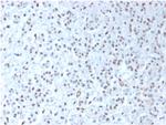 Wilms Tumor 1 (WT1) Antibody in Immunohistochemistry (Paraffin) (IHC (P))