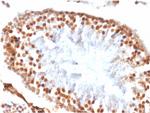 Wilms Tumor 1 (WT1) Antibody in Immunohistochemistry (Paraffin) (IHC (P))