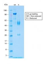 Wilms Tumor 1 (WT1) Antibody in SDS-PAGE (SDS-PAGE)