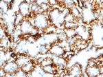 Wilms Tumor 1 (WT1) Antibody in Immunohistochemistry (Paraffin) (IHC (P))