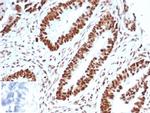 Wilms Tumor 1 (WT1) Antibody in Immunohistochemistry (Paraffin) (IHC (P))