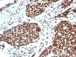 XRCC5 (Ku86/Ku80) (Thyroid-Lupus Autoantigen) Antibody in Immunohistochemistry (Paraffin) (IHC (P))