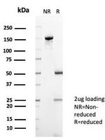 XRCC5 (Ku86/Ku80) (Thyroid-Lupus Autoantigen) Antibody in SDS-PAGE (SDS-PAGE)