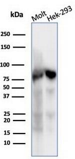 XRCC5 (Ku86/Ku80) (Thyroid-Lupus Autoantigen) Antibody in Western Blot (WB)
