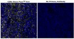 CD8 alpha Antibody in Immunohistochemistry (Paraffin) (IHC (P))