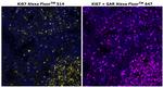 Ki-67 Antibody in Immunohistochemistry (Paraffin) (IHC (P))