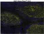 Ki-67 Antibody in Immunohistochemistry (Paraffin) (IHC (P))