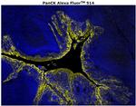 Pan Cytokeratin Antibody in Immunohistochemistry (Paraffin) (IHC (P))