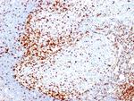 ZAP70 (Chronic Lymphocytic Leukemia Marker) Antibody in Immunohistochemistry (Paraffin) (IHC (P))