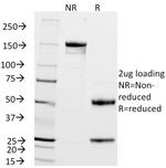 ZAP70 (Chronic Lymphocytic Leukemia Marker) Antibody in SDS-PAGE (SDS-PAGE)