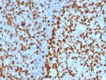 ZAP70 (Chronic Lymphocytic Leukemia Marker) Antibody in Immunohistochemistry (Paraffin) (IHC (P))