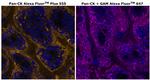 Cytokeratin Pan Type I/II Antibody in Immunohistochemistry (Paraffin) (IHC (P))