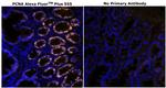 PCNA Antibody in Immunohistochemistry (Paraffin) (IHC (P))