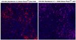 CD138 Antibody in Immunohistochemistry (Paraffin) (IHC (P))