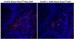 FOXP3 Antibody in Immunohistochemistry (Paraffin) (IHC (P))