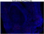 FOXP3 Antibody in Immunohistochemistry (Paraffin) (IHC (P))