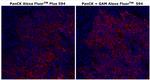 Cytokeratin Pan Type I/II Antibody in Immunohistochemistry (Paraffin) (IHC (P))