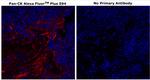 Cytokeratin Pan Type I/II Antibody in Immunohistochemistry (Paraffin) (IHC (P))