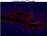 Cytokeratin Pan Type I/II Antibody in Immunohistochemistry (Paraffin) (IHC (P))