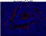 Alpha-Smooth Muscle Actin Antibody in Immunohistochemistry (Paraffin) (IHC (P))