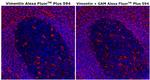 Vimentin Antibody in Immunohistochemistry (Paraffin) (IHC (P))