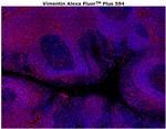 Vimentin Antibody in Immunohistochemistry (Paraffin) (IHC (P))