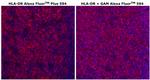 HLA-DR Antibody in Immunohistochemistry (Paraffin) (IHC (P))