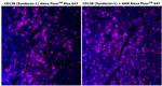 CD138 Antibody in Immunohistochemistry (Paraffin) (IHC (P))