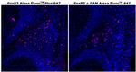 FOXP3 Antibody in Immunohistochemistry (Paraffin) (IHC (P))