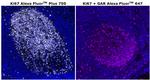 Ki-67 Antibody in Immunohistochemistry (Paraffin) (IHC (P))