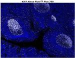 Ki-67 Antibody in Immunohistochemistry (Paraffin) (IHC (P))