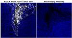 Pan Cytokeratin Antibody in Immunohistochemistry (Paraffin) (IHC (P))