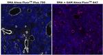 Alpha-Smooth Muscle Actin Antibody in Immunohistochemistry (Paraffin) (IHC (P))