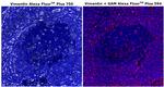 Vimentin Antibody in Immunohistochemistry (Paraffin) (IHC (P))