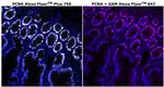 PCNA Antibody in Immunohistochemistry (Paraffin) (IHC (P))